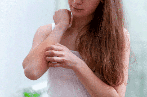 A-woman-scratching-a-rash-which-is-a-side-effect-using-cosmetics