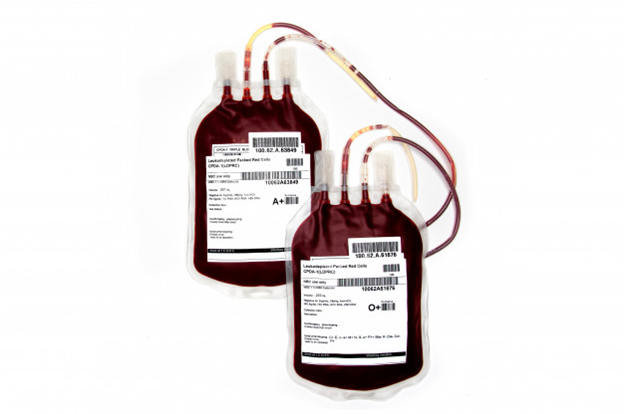 Blood bags usually have paper freezer labels